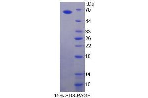 SDS-PAGE analysis of Human gABRA2 Protein. (GABRA2 Protéine)