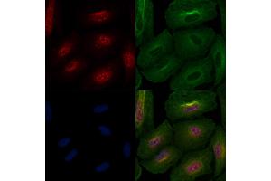 ABIN6264010 and ABIN6276948 staining  cells by IF/ICC.