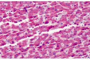 Human Liver: Formalin-Fixed, Paraffin-Embedded (FFPE) (Vitamin D-Binding Protein anticorps)