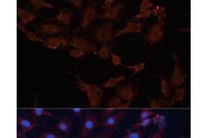 Immunofluorescence analysis of C6 cells using HMGCS1 Polyclonal Antibody at dilution of 1:100 (40x lens).