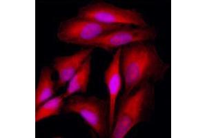 Immunofluorescence (IF) image for anti-Keratin 18 (KRT18) antibody (ABIN567623)