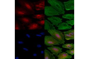 Phospho-SIRT6 (Ser338) Antibody staining A549 cells(4h of LPS treatment) by IF/ICC. (SIRT6 anticorps  (pSer338))
