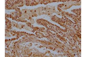 IHC image of ABIN7158304 diluted at 1:300 and staining in paraffin-embedded human lung tissue performed on a Leica BondTM system. (LTC4S anticorps  (AA 36-51))