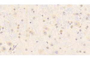 Detection of RBP2 in Mouse Cerebrum Tissue using Polyclonal Antibody to Retinol Binding Protein 2, Cellular (RBP2)