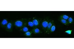 IF analysis of TTC11/FIS1 using anti-TTC11/FIS1 antibody (ABIN7600321). (Fission 1 anticorps  (AA 18-152))