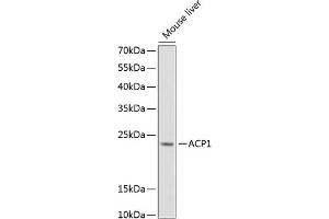 Western blot analysis of extracts of mouse liver, using  Antibody (ABIN6127321, ABIN6136446, ABIN6136448 and ABIN6216005) at 1:1000 dilution. (ACP1 anticorps  (AA 1-158))