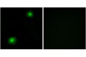 Immunofluorescence analysis of A549 cells, using ZNF187 Antibody. (ZNF187 anticorps  (AA 51-100))