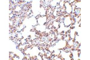 Immunohistochemistry of SKIL in mouse lung tissue with SKIL polyclonal antibody  at 5 ug/mL . (SKIL anticorps  (N-Term))