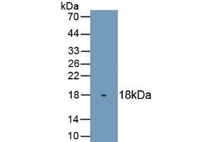 Detection of Recombinant TP63, Human using Monoclonal Antibody to Tumor Protein P63 (TP63) (p63 anticorps  (AA 540-680))