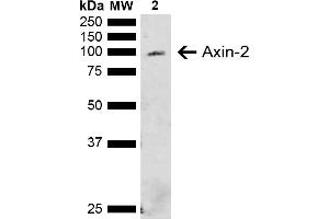 Western blot analysis of Rat Liver showing detection of ~93.