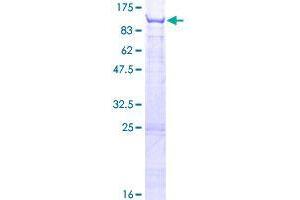 Image no. 1 for tRNA Methyltransferase 1 (TRMT1) (AA 1-659) protein (GST tag) (ABIN1323790)