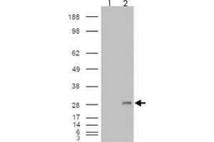 293 overexpressing IGFBP6 and probed with IGFBP6 polyclonal antibody  (mock transfection in first lane), tested by Origene.