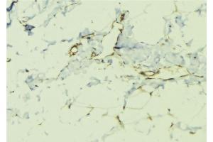 ABIN6276411 at 1/100 staining Human lung tissue by IHC-P.