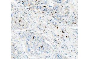IHC analysis of CD68 using anti-CD68 antibody (ABIN7600142). (CD68 anticorps  (AA 154-354))