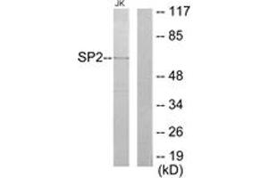 Western Blotting (WB) image for anti-Sp2 Transcription Factor (Sp2) (AA 471-520) antibody (ABIN2889540) (Sp2 anticorps  (AA 471-520))