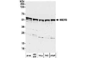 anti-Mesoderm Induction Early Response 1, Family Member 3 (MIER3) (AA 400-450) antibody