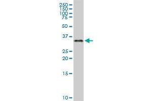 ZNF346 MaxPab rabbit polyclonal antibody. (ZNF346 anticorps  (AA 1-294))