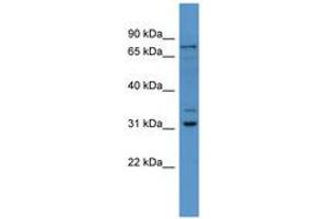 Image no. 1 for anti-F-Box Protein 34 (FBXO34) (AA 71-120) antibody (ABIN6746487) (FBXO34 anticorps  (AA 71-120))