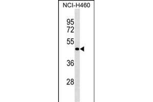 SG Antibody (N-term) (ABIN1539497 and ABIN2849755) western blot analysis in NCI- cell line lysates (35 μg/lane). (SGPP2 anticorps  (N-Term))