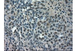 HEK293T cells were transfected with the pCMV6-ENTRY control (Left lane) or pCMV6-ENTRY SLC2A5 (Right lane) cDNA for 48 hrs and lysed.