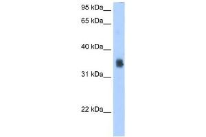 SLC35F2 antibody used at 2. (SLC35F2 anticorps  (N-Term))