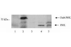 Image no. 1 for anti-Polynucleotide Kinase 3'-Phosphatase (PNKP) (Internal Region) antibody (ABIN401253) (PNKP anticorps  (Internal Region))
