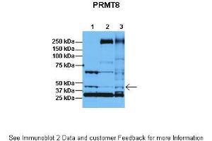 Lanes:   1: 30ug HeLa lysate, 2: 30ug HFF lysate, 3: 30ug U2OS lysate  Primary Antibody Dilution:   1:1000  Secondary Antibody:   Anti-rabbit HRP  Secondary Antibody Dilution:   1:5000  Gene Name:   PRMT8  Submitted by:   Dr. (PRMT8 anticorps  (C-Term))