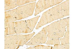ABIN7094264 and ABIN7098311 at 1/100 staining Mouse muscle tissue by IHC-P.
