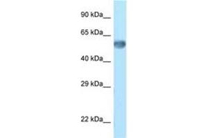 Image no. 1 for anti-Zinc Finger Protein 394 (ZNF394) (C-Term) antibody (ABIN6748078) (ZNF394 anticorps  (C-Term))