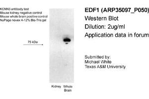 Western Blotting (WB) image for anti-Small Conductance Calcium-Activated Potassium Channel Protein 3 (KCNN3) (C-Term) antibody (ABIN2776146) (KCNN3 anticorps  (C-Term))