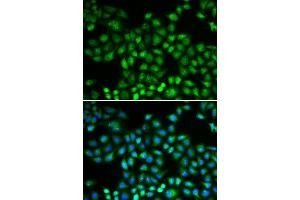 Immunofluorescence analysis of MCF-7 cells using PSMB1 antibody.