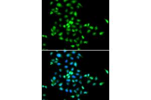 Immunofluorescence analysis of MCF-7 cells using SBDS antibody (ABIN5973483). (SBDS anticorps)