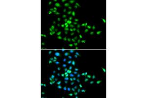 Immunofluorescence analysis of MCF-7 cells using SBDS antibody (ABIN5973483). (SBDS anticorps)