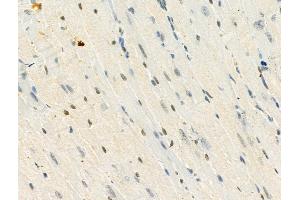 Phospho-MeCP2 (Ser423) Antibody at 1/100 staining Mouse heart tissue by IHC-P.