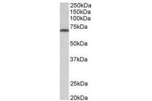 AP31698PU-N (0. (MTHFR anticorps  (Internal Region))