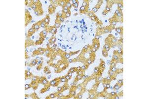 Immunohistochemistry of paraffin-embedded human liver using CCL25 antibody at dilution of 1:100 (40x lens). (CCL25 anticorps)