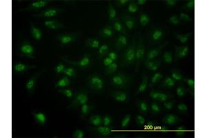 Immunofluorescence of monoclonal antibody to CDC14A on HeLa cell. (CDC14A anticorps  (AA 431-530))