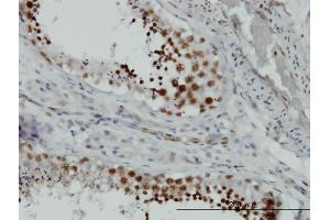 Immunoperoxidase of monoclonal antibody to HMGB2 on formalin-fixed paraffin-embedded human testis. (HMGB2 anticorps  (AA 1-195))
