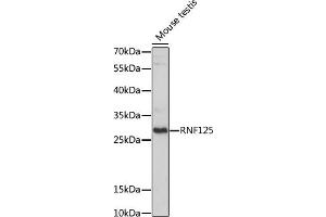 Western blot analysis of extracts of Mouse testis, using RNF125 antibody (ABIN7270057) at 1:1000 dilution. (RNF125 anticorps  (AA 1-105))