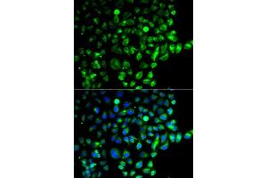 Immunofluorescence analysis of  cells using R antibody (ABIN6128595, ABIN6146569, ABIN6146571 and ABIN6220321). (RAB31 anticorps  (AA 1-195))