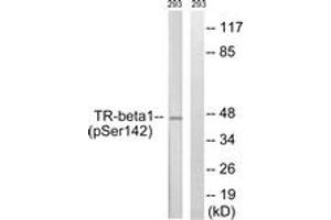 Western blot analysis of extracts from 293 cells treated with PMA 125ng/ml 30', using TR-beta1 (Phospho-Ser142) Antibody.