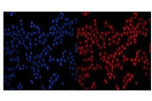 IF analysis of GP210/NUP210 using anti-GP210/NUP210 antibody (ABIN7600707). (NUP210 anticorps  (AA 221-1724))