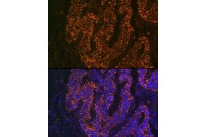 Immunofluorescence analysis of human colon carcinoma cells using CE Rabbit mAb (ABIN7266085) at dilution of 1:100 (40x lens). (CEACAM6 anticorps)