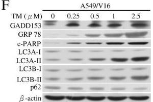 Analyses of GMI, TG and TM regulated ER stress, apoptosis and autophagy by Western blotting.
