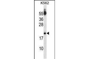 Western blot analysis in K562 cell line lysates (35ug/lane). (SAP18 anticorps  (AA 58-86))