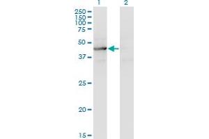 Western Blot analysis of TEX28 expression in transfected 293T cell line by TEX28 monoclonal antibody (M05), clone 1A8.