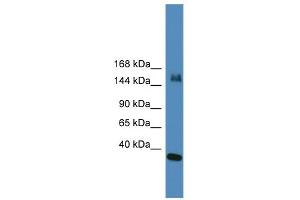 WB Suggested Anti-UTX Antibody Titration:  0. (KDM6A anticorps  (N-Term))