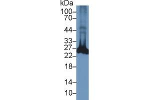 Detection of UCHL1 in Rat Spinal cord lysate using Polyclonal Antibody to Ubiquitin Carboxyl Terminal Hydrolase L1 (UCHL1)