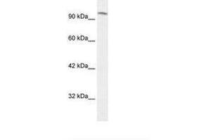 Image no. 1 for anti-SWI/SNF Related, Matrix Associated, Actin Dependent Regulator of Chromatin, Subfamily C, Member 1 (SMARCC1) (AA 828-877) antibody (ABIN203279)