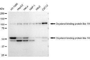 Western blotting analysis using Oxysterol binding protein like 1A antibody (ABIN7799716). (Recombinant OSBPL1A anticorps)